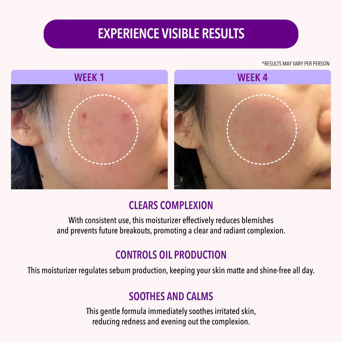 Crema Facial Control Grasa